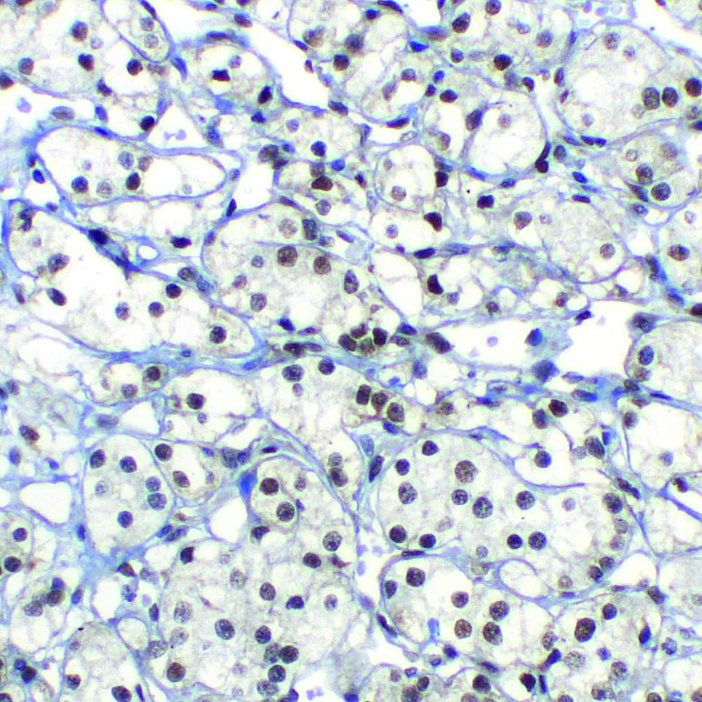 TFE3-EP285 | PathnSitu Biotechnologies