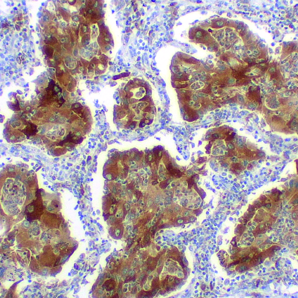 ROS1 - EP282 | PathnSitu Biotechnologies