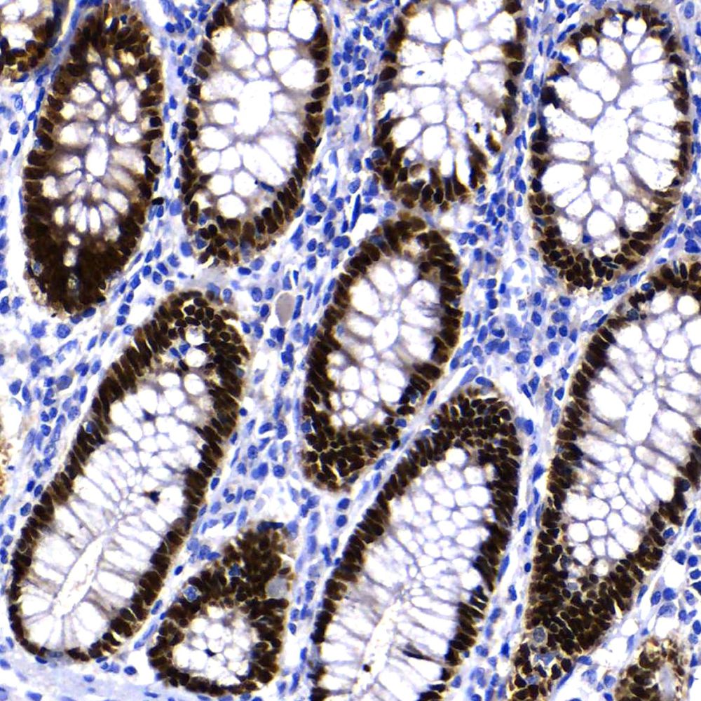 Normal colon Stained with Anti-CDX2
