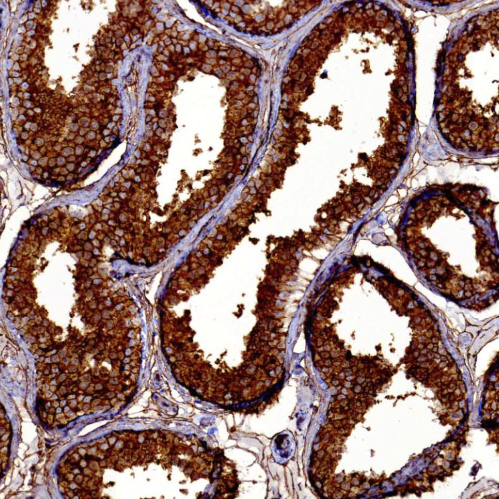Testis stained with Anti-CD99