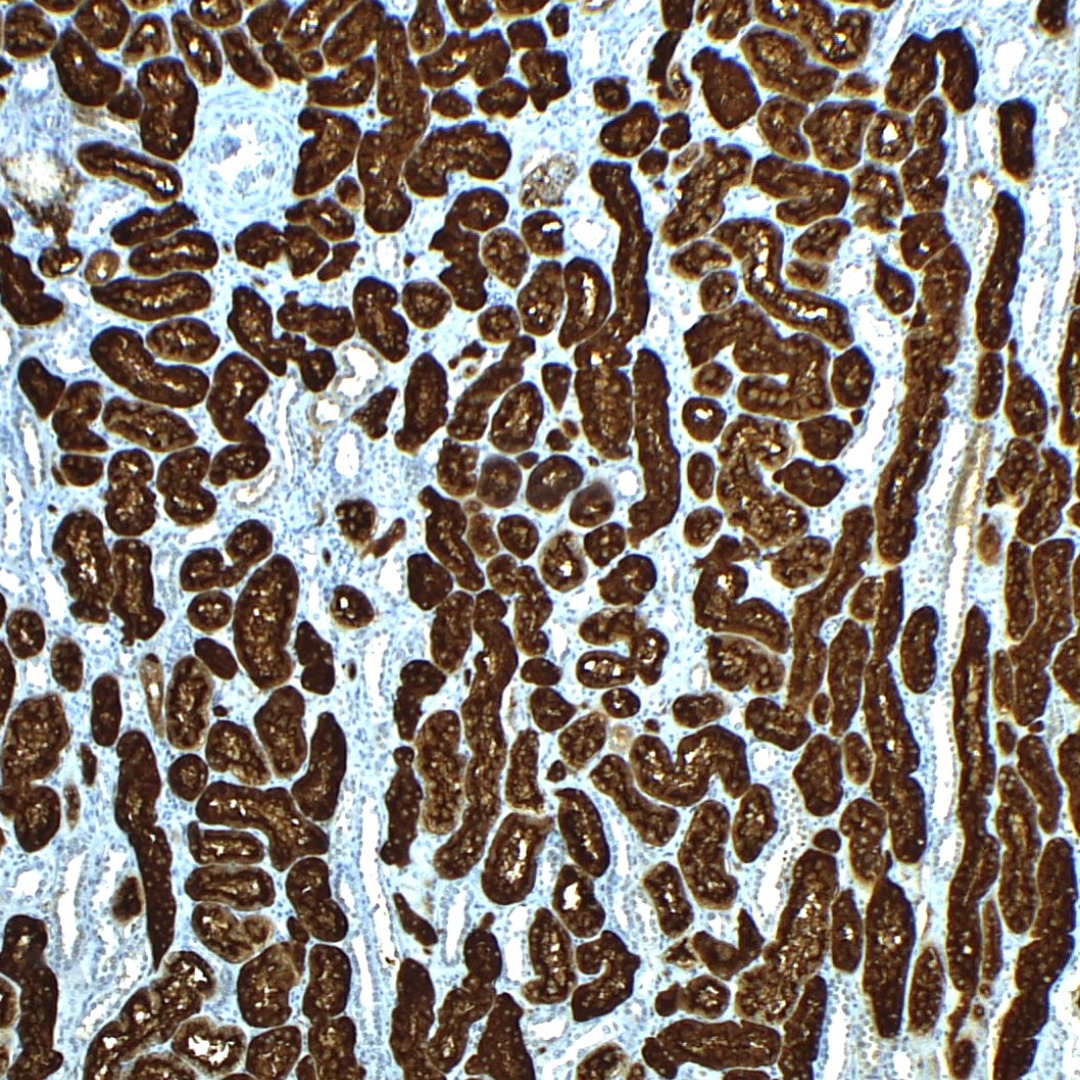 CD13- EP117 | PathnSitu Biotechnologies